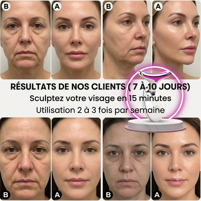 Masseur électrique du visage